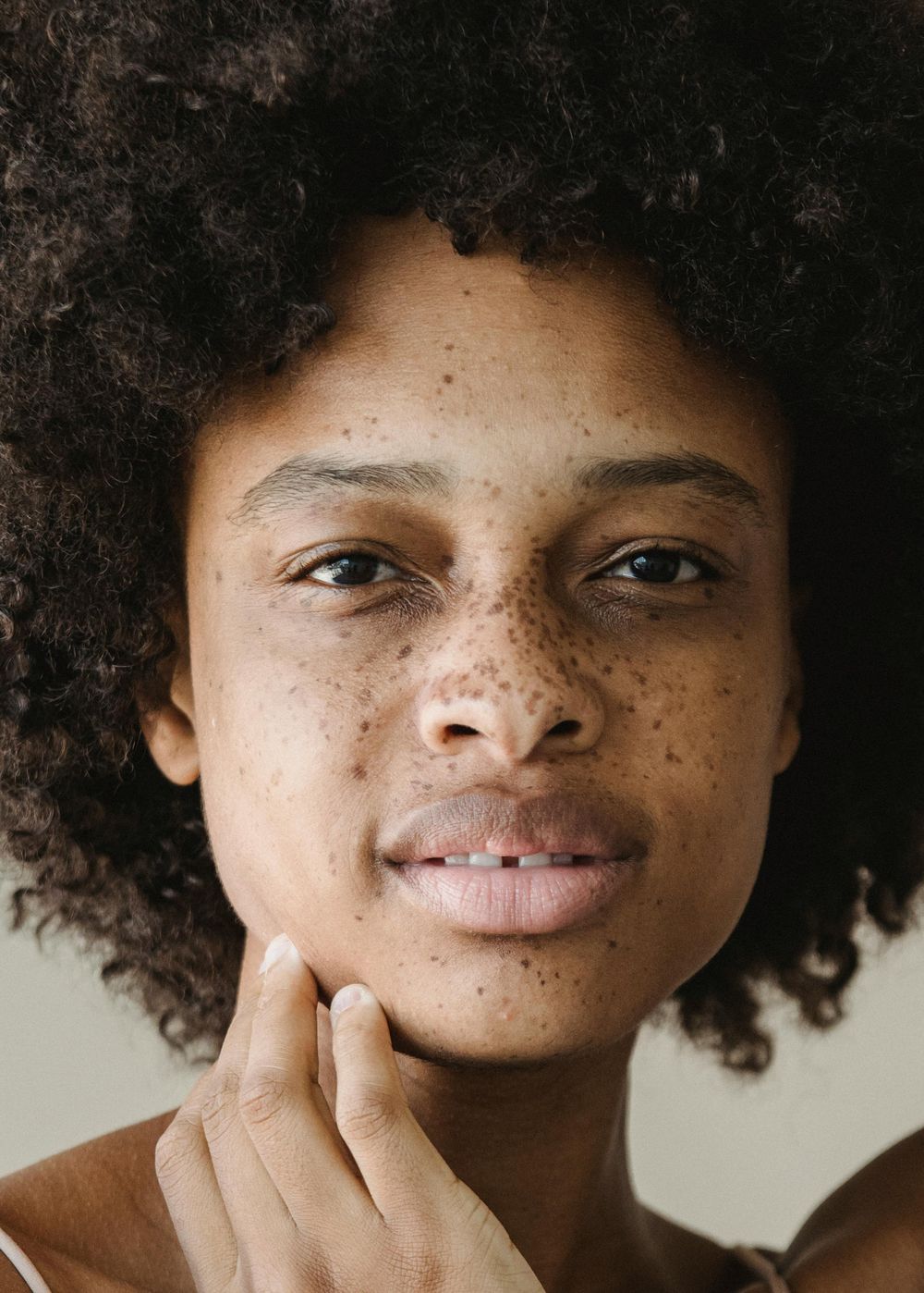 Retrato de mulher com sardas, mão no queixo